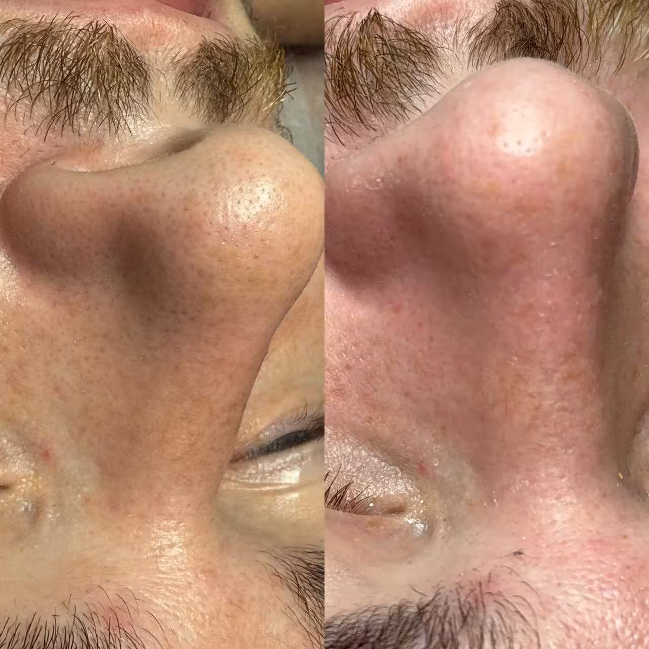Beauty Care island İstanbul - Şişli Güzellik Merkezi - Bomonti Cilt Bakımı - Manikür Pedikür - G5 - G8 - Wax - Ağda — Güzellik Salonları, Şişli · fotoğraf 5