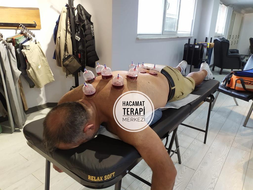 Hacamat Terapi Merkezi / Hacamat ve Sülük Tedavisi