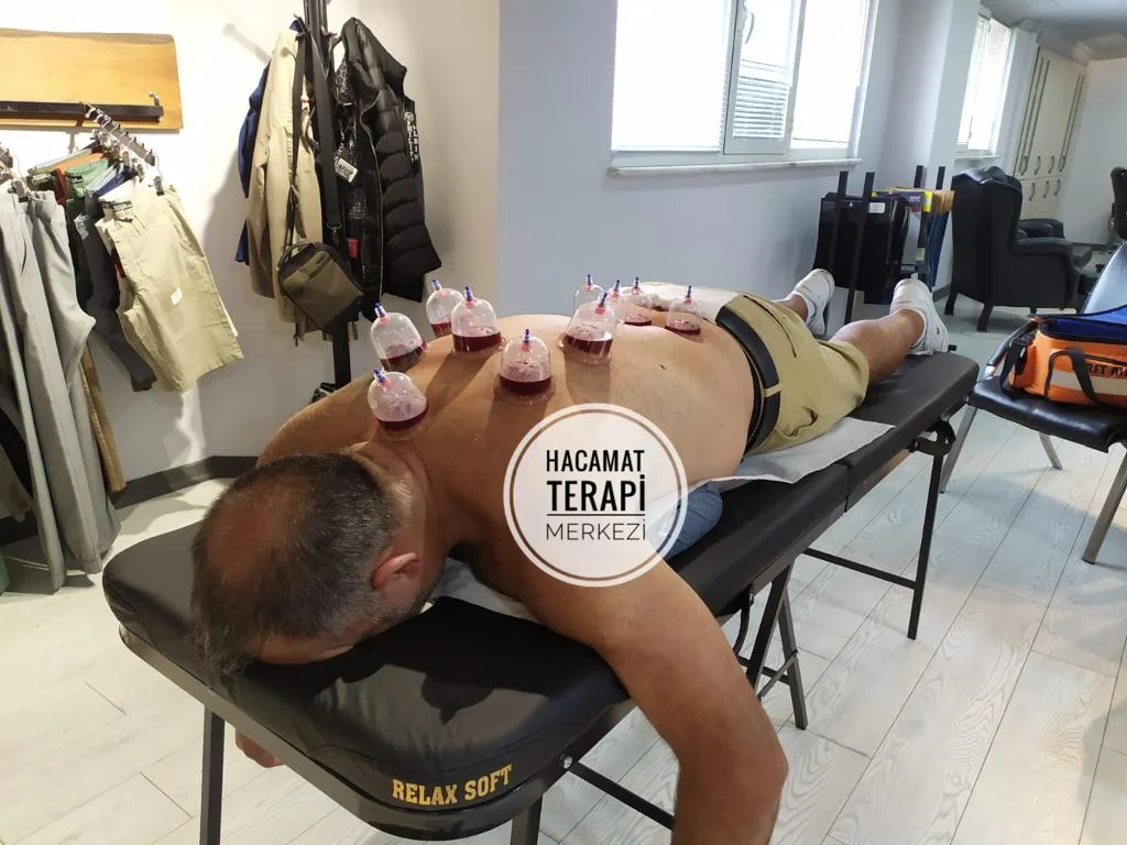 Hacamat Terapi Merkezi / Hacamat ve Sülük Tedavisi — Fizyoterapistler, Avcılar · fotoğraf 1