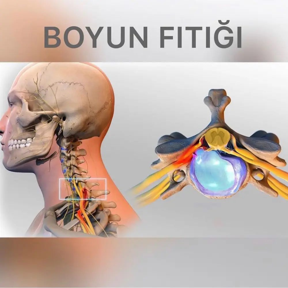 Fizyonet İstanbul – Ataşehir Fizyoterapi ve Manuel Terapi Merkezi — Fizyoterapistler, Ataşehir · fotoğraf 4