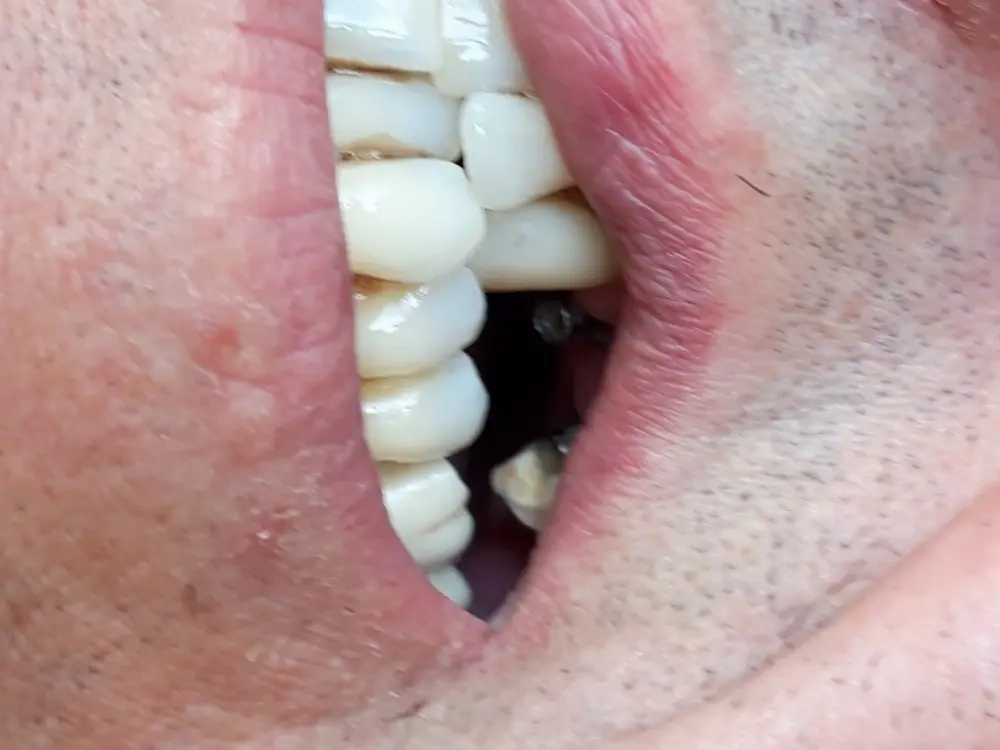 Dentamar Ağız ve Diş Sağlığı Polikliniği Kalamış — Diş Hekimleri, Kadıköy · fotoğraf 3