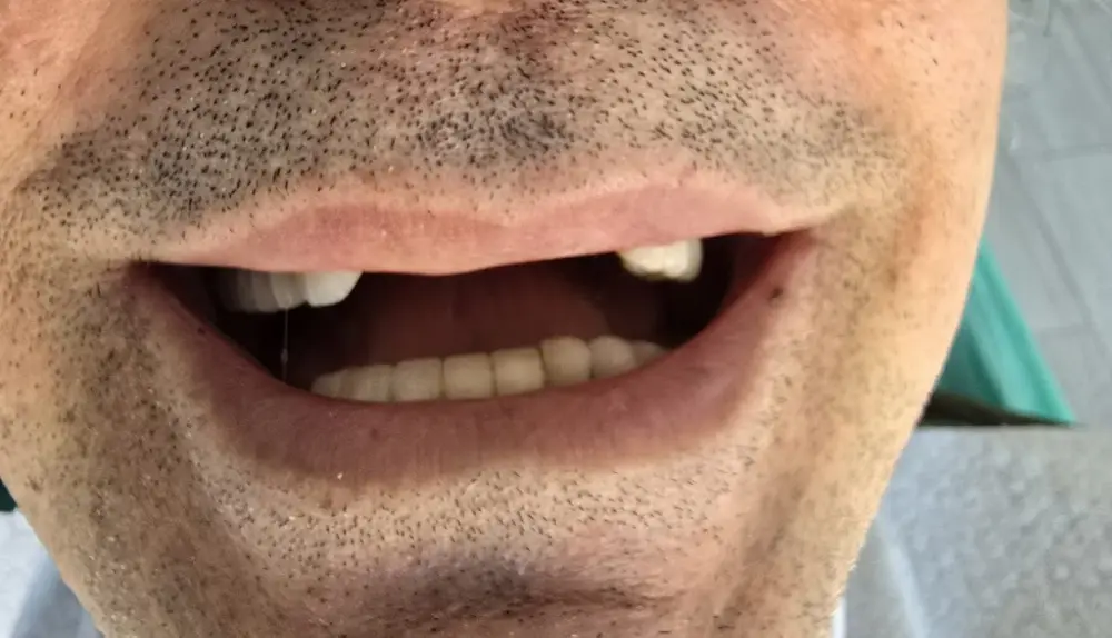 Diş Hekimi Gökay Kartal | Kadıköyde İmplant Tedavisi | Kadıköyde Diş Hekimi | Kadıköyde Diş Polikliniği — Diş Hekimleri, Kadıköy · fotoğraf 3