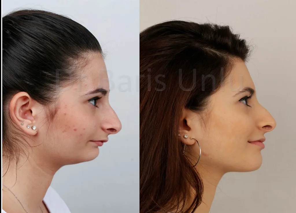 Ortodontist Diş Kliniği — Diş Hekimleri, Ataşehir · fotoğraf 1