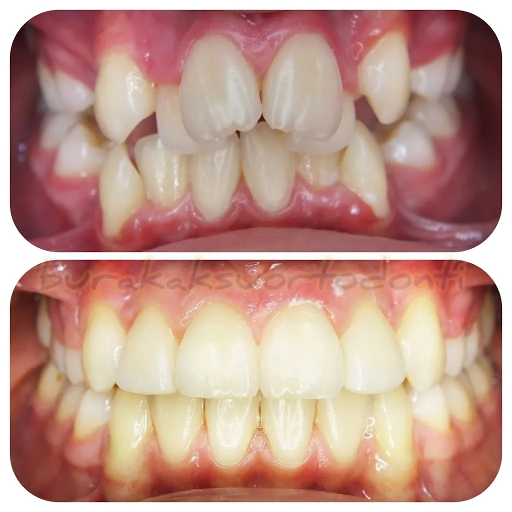 Dr Burak Aksu Ortodonti Uzmanı — Diş Hekimleri, Ataşehir · fotoğraf 1