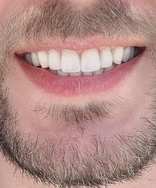 Dentpoint Ağız Ve Diş Sağlığı Polikliniği — Diş Hekimleri, Ataşehir · fotoğraf 2