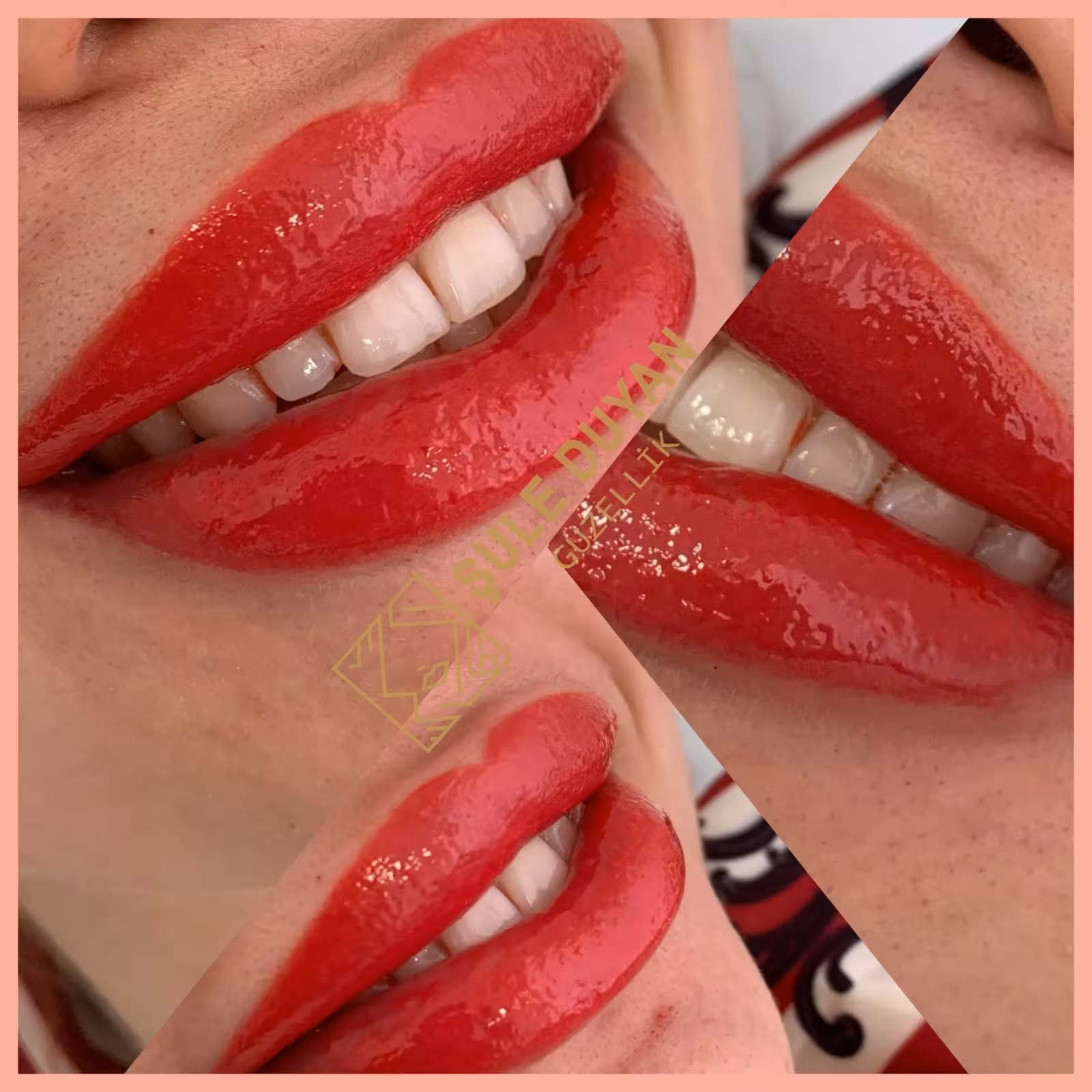 Şule Duyan Beauty Clinic - Hydrafacial / Medical Aesthetic / Laser Hair Removal - görsel 4